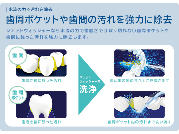 歯磨きでは取り切れない歯周ポケットや歯間に残った汚れを強力に除去 